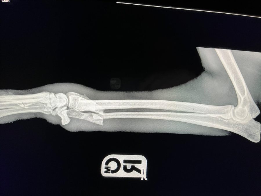 xray of colin's leg